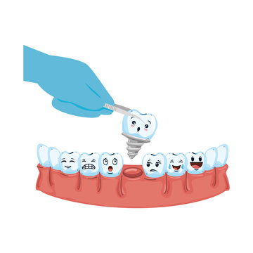 human teeth with pliers extracting implant