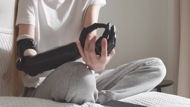 Woman's hands holding artificial arm. health and body care.long-term stability and effectiveness of cyber arm