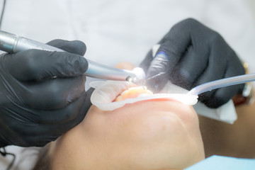 Close up of dentist hand drilling the teeth and spraying the water