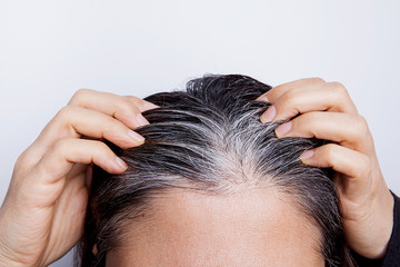 Young woman with white hair problem