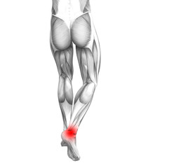 Conceptual ankle human anatomy with red hot spot inflammation or articular joint pain for leg health care therapy or sport muscle concepts. 3D illustration man arthritis or bone osteoporosis disease