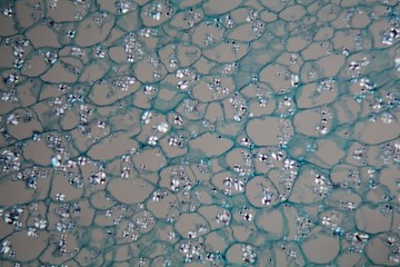 Potato cells with starch corns under the microscope
