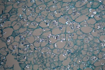 Potato cells with starch corns under the microscope