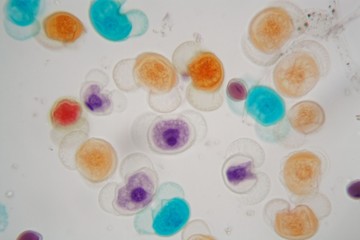 Pollen grains of different species under the microscope