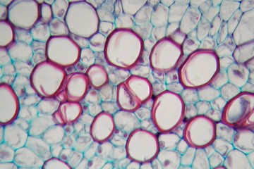 Sambucus stem with parenchyma cells under the microscope