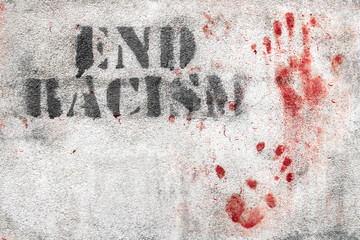 End racism