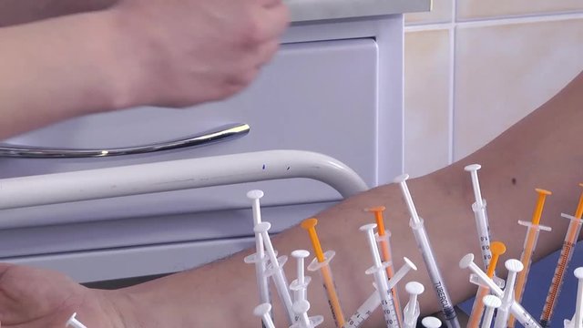 Doctor testing allergy reaction of patient in hospital. Skin test for allergens.