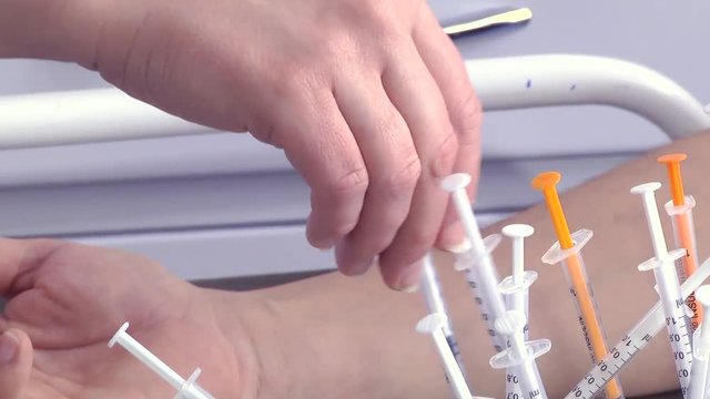 Medical doctor doing allergy tests in laboratory. Skin test for allergens. 