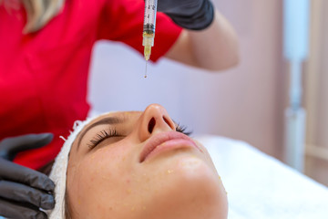 Needle mesotherapy in beauty clinic. Cosmetics injected to woman's face. Needle mesotherapy, face lift. Microneedle mesotherapy. Needle mesotherapy treatment on a woman face.