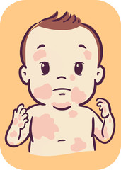 Baby Skin Rashes Illustration