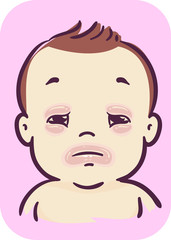 Baby Swollen Eyelids Lips Illustration