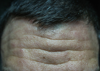 Naklejka premium Forehead with wrinkles