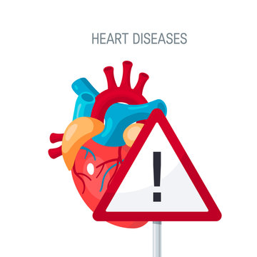 Heart diseases vector concept in flat style