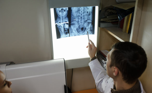Close up view: picture of  doctor exploring spinal x-ray: lumbar and cervical region - first 2 cervical vertebrae (axis and atlas), coxofemural joint.