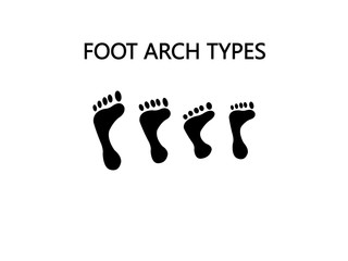 Foot arch types