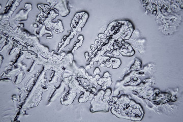 Tears viewed at the microscope. Magnification 100-1000x