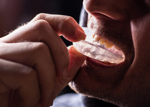 boxer teeth protection. mouthguard