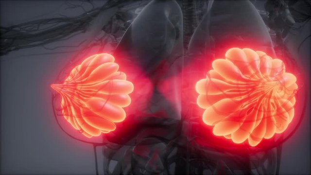 3d rendered medically accurate illustration of an obese womens mammary glands