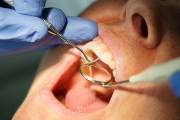 Dental patient getting her incisors teeth and gums examined