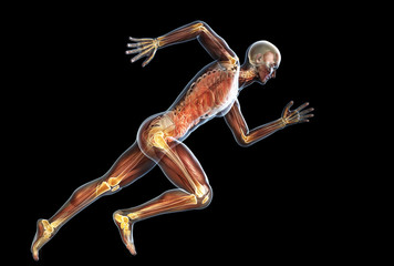 Arthritic joints (yellow), medically 3D illustration on black background