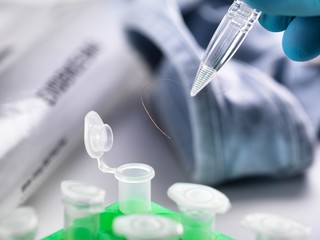 Forensic Investigation