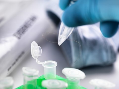 Forensic Investigation