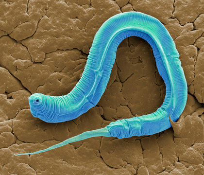 C elegans, SEM