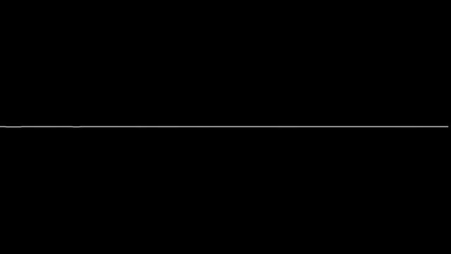 Visual representation of a heartbeat that stops