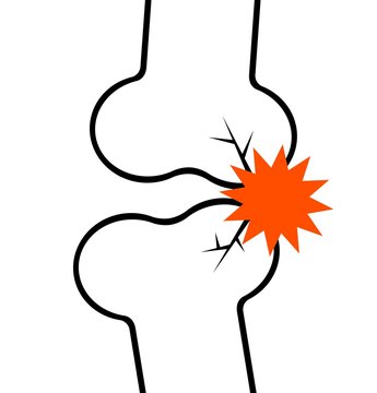 knee joint pain orange burst clip art preview
