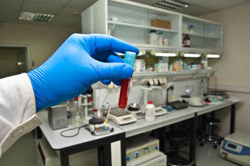 Fototapeta na wymiar Laboratory study of blood.