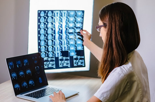 Female doctor specialist studying mri brain scan