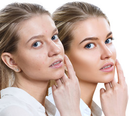 Obraz na płótnie Canvas Young woman before and after skin treatment and makeup.