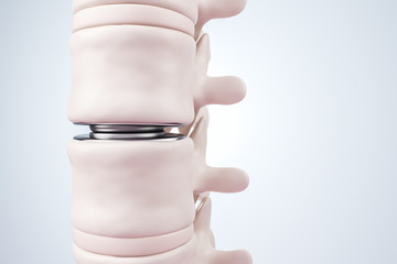 Illustration of intervertebral disc prosthesis. Close up view. 3d render.