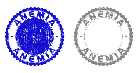 Grunge ANEMIA stamp seals isolated on a white background. Rosette seals with grunge texture in blue and gray colors. Vector rubber imitation of ANEMIA tag inside round rosette.