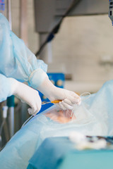 Retinal surgery. The doctor in the operating room