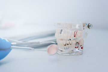 Stomatology. Model of the jaw made of glass. Hand in glove with tools for dentistry. Pulpitis and caries