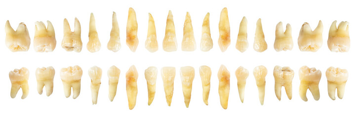 Tooth diagram ( photography ). Real teeth chart . front horizontal view . isolated white background