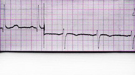 tape with cardiogram graph
