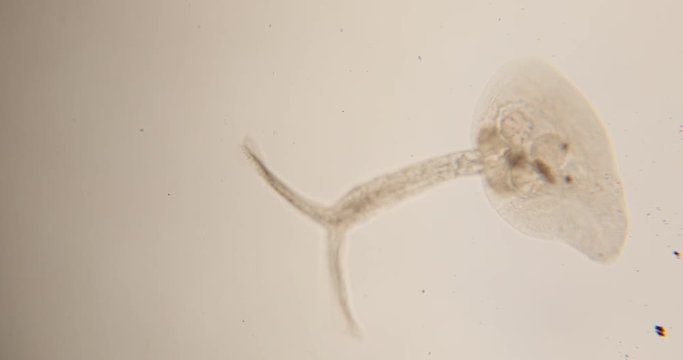Study Movement and Specimens of Transversotrema patiallensis (parasite) under the microscopic in laboratory.
