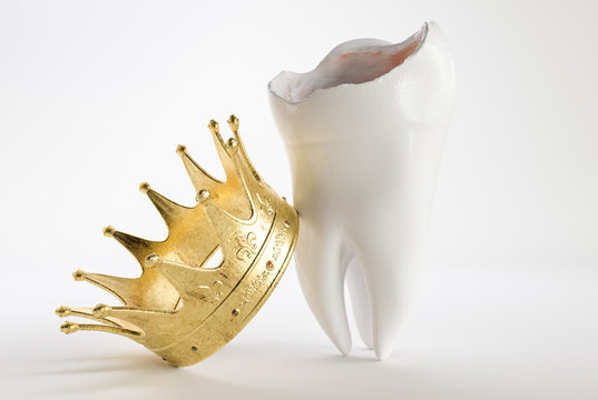 Tooth with a crown - 3D Rendering