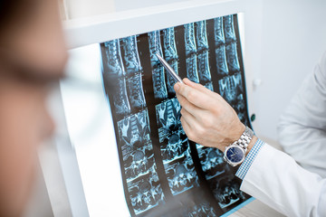 Man during the medical consultation with senior therapist looking on the tomography print at the office