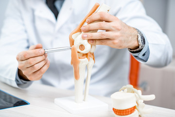 Close-up of the therapist showing knee joint model during the medical consultation - obrazy, fototapety, plakaty