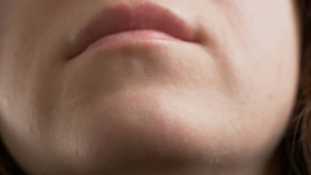 Dry skin closeup