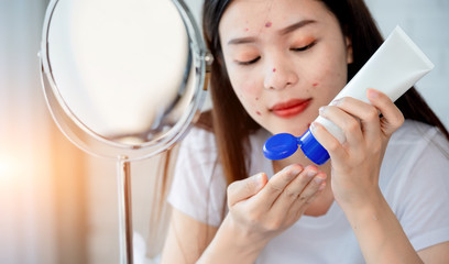 Asian teenage woman  looking at mirror and squeeze acne problem on her face, skin care concept.