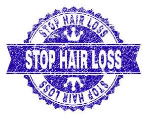 STOP HAIR LOSS rosette seal watermark with grunge texture. Designed with round rosette, ribbon and small crowns. Blue vector rubber watermark of STOP HAIR LOSS title with unclean texture.