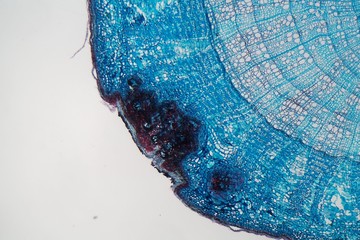Cells of a plant stem with a disease under a microscope