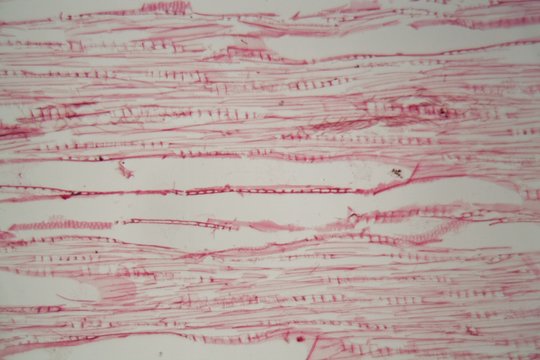 Wood cells destroyed by fungus under a microscope