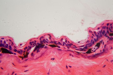 Amphibian skin with ulcer under a microscope