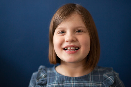 Portrait Of Kid Girl With Bracket On Teeth On Blue