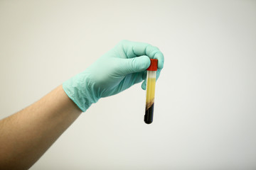 Details with the hand of a doctor holding a vial of blood plasma extracted from blood by...